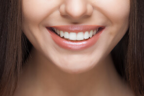 Teeth Whitening